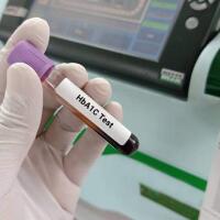 EMOGLOBINA GLICATA - Farmacia Diciotto